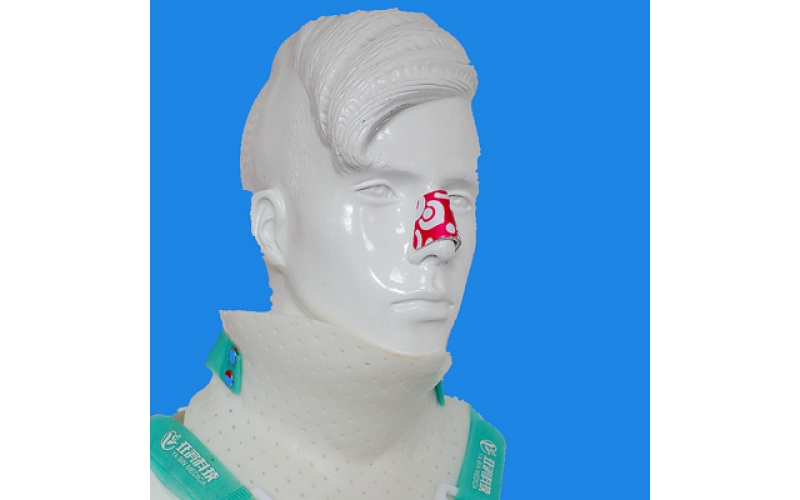 Nasal Splint